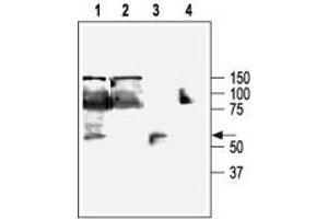 Western blot analysis of KCa3. (KCNN4 anticorps  (C-Term, Intracellular))