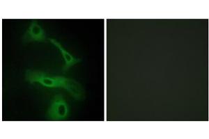 Immunofluorescence analysis of HeLa cells, using CLUS antibody. (Clusterin anticorps  (C-Term))