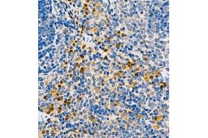 Immunohistochemistry of paraffin embedded rat splenitis using CCL3 (ABIN7073450) at dilution of 1:1000 (400x lens) (CCL3 anticorps)