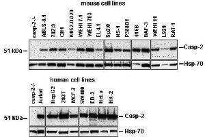 Western Blotting (WB) image for anti-Caspase 2, Apoptosis-Related Cysteine Peptidase (CASP2) antibody (ABIN187544) (Caspase 2 anticorps)