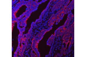 IF analysis of NDUFS5 using anti-NDUFS5 antibody (ABIN7598943).