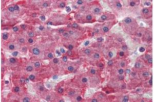 Human Liver: Formalin-Fixed, Paraffin-Embedded (FFPE) (CBS anticorps  (AA 1-101))