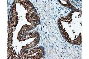 Immunohistochemical staining of paraffin-embedded Kidney tissue using anti-L1CAM mouse monoclonal antibody. (L1CAM anticorps)