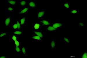 Immunofluorescence of purified MaxPab antibody to HMBS on HeLa cell.