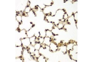 Immunohistochemistry of paraffin-embedded mouse lung using SULT2B1 antibody at dilution of 1:100 (x40 lens). (SULT2B1 anticorps)