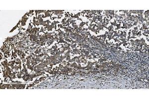 IHC analysis of MAP3K8 using anti-MAP3K8 antibody (ABIN4886663). (MAP3K8 anticorps  (AA 9-193))