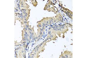 Immunohistochemistry of paraffin-embedded human prostate using CXCR4 antibody. (CXCR4 anticorps)