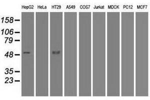 Image no. 6 for anti-serpin Peptidase Inhibitor, Clade A (Alpha-1 Antiproteinase, Antitrypsin), Member 1 (SERPINA1) antibody (ABIN1500874) (SERPINA1 anticorps)