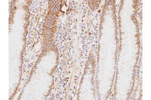 IHC-P Image Immunohistochemical analysis of paraffin-embedded human stomach , using HADHA, antibody at 1:100 dilution.