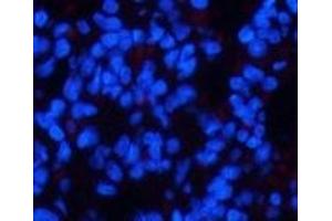 Immunofluorescence analysis of Rat lung tissue using Phospho-CHEK2 (Thr68) Polyclonal Antibody at dilution of 1:200 (CHEK2 anticorps  (pThr68))