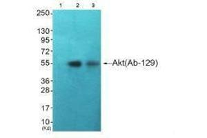 Western blot analysis of extracts from HuvEc cells (Lane 2) and JK cells (Lane 3), using Akt (Ab-129) antiobdy. (AKT1 anticorps  (Ser129))