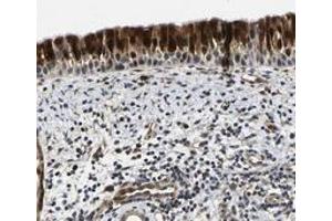 Immunohistochemical staining of human nasopharynx with C12orf35 polyclonal antibody  shows strong nuclear and cytoplasmic positivity in respiratory epithelial cells. (KIAA1551 anticorps)
