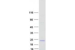 Validation with Western Blot
