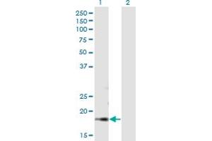 Western Blot analysis of DBF4B expression in transfected 293T cell line by DBF4B MaxPab polyclonal antibody. (DBF4B/DRF1 anticorps  (AA 1-170))
