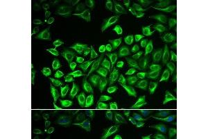 Immunofluorescence analysis of A549 cells using HAS3 Polyclonal Antibody
