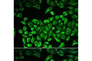Immunofluorescence analysis of A549 cells using HAS3 Polyclonal Antibody (HAS3 anticorps)