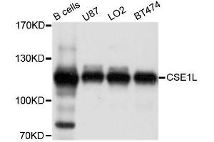 Western blot analysis of extracts of various cell lines, using CSE1L antibody. (Exportin 2 anticorps  (AA 50-150))