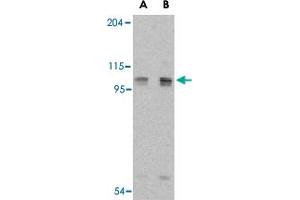 Western blot analysis of AOF2 in P815 cell lysate with AOF2 polyclonal antibody  at (A) 1 and (B) 2 ug/mL . (LSD1 anticorps  (Internal Region))