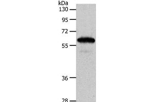 Western Blot analysis of Mouse brain tissue using INA Polyclonal Antibody at dilution of 1:550 (INA anticorps)