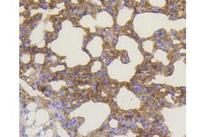 Immunohistochemistry of paraffin-embedded mouse lung using BAK1 antibody (ABIN4903006) at dilution of 1:100 (40x lens). (BAK1 anticorps)