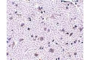 Immunohistochemistry (IHC) image for anti-Cerebral Dopamine Neurotrophic Factor (CDNF) (N-Term) antibody (ABIN1031315)