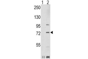 Western blot analysis of PAK1 antibody and 293 cell lysate either nontransfected (Lane 1) or transiently transfected with the PAK1 gene (2).