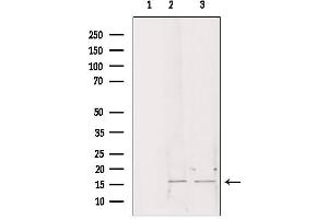 Western blot analysis of extracts from various samples, using CHCHD2 antibody. (CHCHD2 anticorps  (Internal Region))