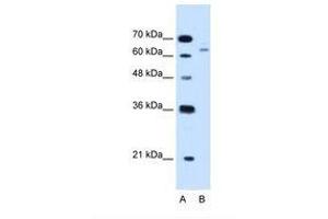 Image no. 2 for anti-Cystathionine-beta-Synthase (CBS) (AA 164-213) antibody (ABIN320982) (CBS anticorps  (AA 164-213))