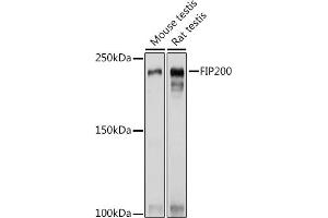Western blot analysis of extracts of various cell lines, using FIP200 Rabbit pAb (ABIN7269881) at 1:1000 dilution.