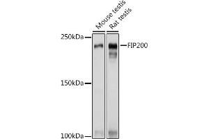 Western blot analysis of extracts of various cell lines, using FIP200 Rabbit pAb (ABIN7269881) at 1:1000 dilution. (FIP200 anticorps  (C-Term))