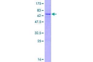 Image no. 1 for Growth Factor Independent 1B Transcription Repressor (GFI1B) (AA 1-330) protein (GST tag) (ABIN7540260)