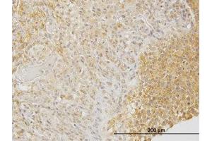 Image no. 1 for anti-Dihydropyrimidinase-Like 3 (DPYSL3) (AA 457-556) antibody (ABIN598653) (DPYSL3 anticorps  (AA 457-556))