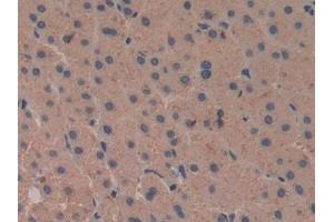 Detection of COX 2 in Human Liver Tissue using Polyclonal Antibody to Cyclooxygenase-2 (COX 2)