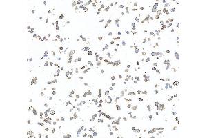 Immunocytochemistry (ICC) image for anti-AXL Receptor tyrosine Kinase (AXL) (AA 33-440) antibody (ABIN7453376)