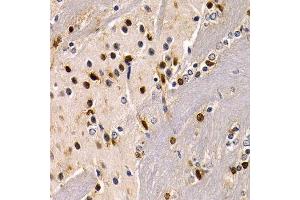 Immunohistochemistry of paraffin-embedded mouse brain using SOX2 antibody.