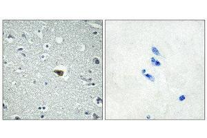 Immunohistochemistry (IHC) image for anti-Brain-Specific Angiogenesis Inhibitor 1 (BAI1) (Internal Region) antibody (ABIN6301192) (BAI1 anticorps  (Internal Region))