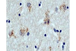 DAB staining of ATG5 in paraffin - embedded human brain section (midfrontal cortex, Alzheimer case) using rabbit ATG5 polyclonal antibody  . (ATG5 anticorps  (C-Term))