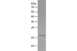 Western Blotting (WB) image for Creatine Kinase, Muscle (CKM) (AA 1-162) protein (His tag) (ABIN7122496)