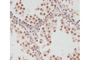 Immunohistochemistry of paraffin-embedded Rat testis using Phospho-PEA15(S104) Polyclonal Antibody at dilution of 1:100 (40x lens).