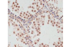 Immunohistochemistry of paraffin-embedded Rat testis using Phospho-PEA15(S104) Polyclonal Antibody at dilution of 1:100 (40x lens). (PEA15 anticorps  (pSer104))