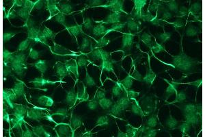 Immunocytochemistry (ICC) image for anti-Protein Kinase C, zeta (PRKCZ) antibody (ABIN870323)