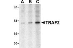 Western blot analysis of TRAF2 in human liver tissue lysate with this product at (A) 0. (TRAF2 anticorps  (N-Term))