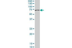 ACADVL monoclonal antibody (M01), clone 5D3 Western Blot analysis of ACADVL expression in Hela S3 NE .