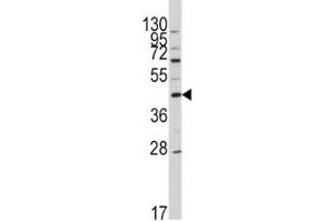 Western blot analysis of APOA5 antibody and HL-60 lysate. (APOA5 anticorps  (AA 22-52))