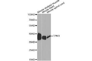 Western blot analysis of extracts of various cell lines, using TPM3 antibody (ABIN1875182) at 1:1000 dilution. (TPM3 anticorps)