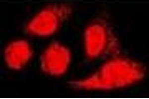 Immunofluorescent analysis of PA28 alpha staining in U2OS cells. (PSME1 anticorps)