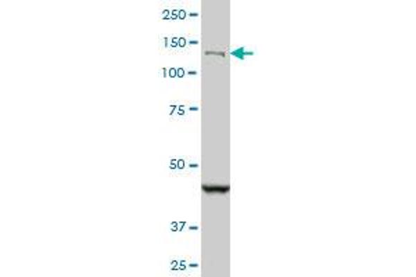 DHX8 antibody  (AA 301-400)
