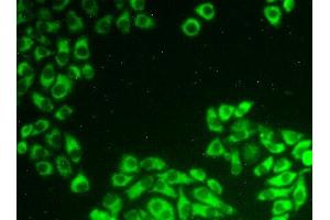 Figure:FITC staining on IHC-P Simple: Hela cells