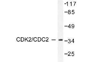 Image no. 1 for anti-Cyclin-Dependent Kinase 2 (CDK2) antibody (ABIN265345) (CDK2 anticorps)
