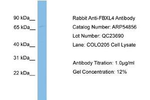 WB Suggested Anti-FBXL4  Antibody Titration: 0.